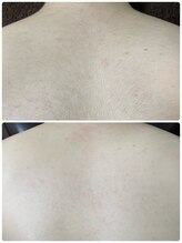 エン(en.)/BeforeAfter写真31