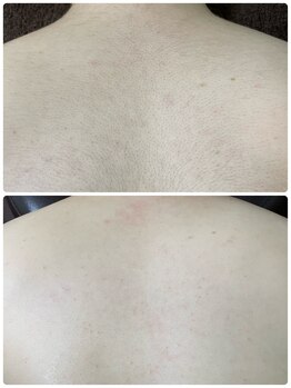 エン(en.)/BeforeAfter写真31