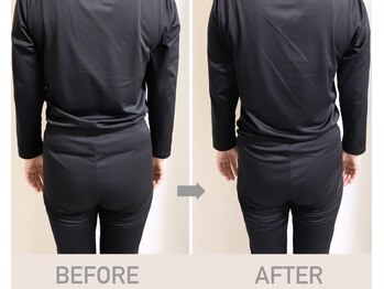 ヨサパーク ナズ(YOSA PARK nazu)/1回の施術のBefore→after