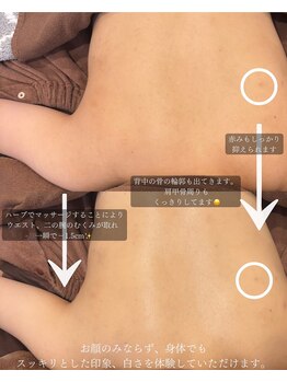 シツ(SHITSU)/背中ハーブピーリング・結婚式◎