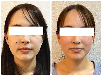 美容整体ウェリナ 名駅院/小顔矯正/骨盤矯正/美脚サロン