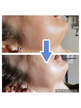 ミホズルーム(Miho‘s room)/くすみ激変!