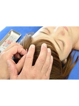 鍼灸施術を受けたい