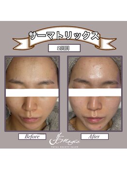 ビーマジック(美magic)/サーマトリックス