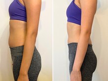 リアスパイア 横浜関内(ReAspire)/ヒップアップはお任せください！