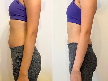 リアスパイア 横浜関内(ReAspire)/ヒップアップはお任せください!