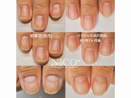 自爪育成中（クリア仕上げ）