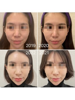 ラ クレール ビューティーサロン(LA CLAIR)/小顔リフトマシン豊富に取り揃え