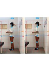 ゼロスポアドバンス 新潟万代店(ZEROSPO ADVANCE)/姿勢・歪みを分析