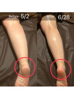 ヌーアンドコードット バイ リンパシー(Nu & Co. by Lymphthy)/いいこといっぱい!巡りケア!