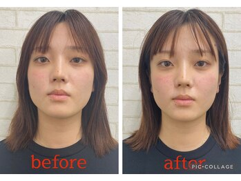 天空のゆりかご 八王子店/施術１回で即実態感！