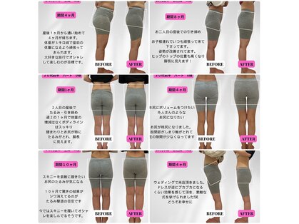 ビジリンヌの写真