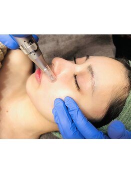 ホウレイ線・たるみ改善！予防ケア