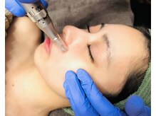 オルオル(Olu'olu)