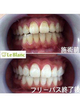 ルブラン 奈良店(Le Blanc)/あけましておめでとうございます