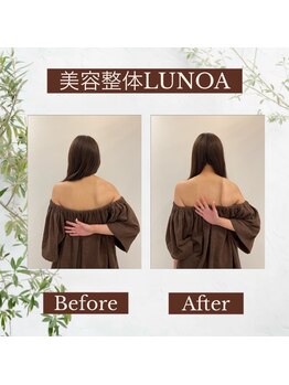 美容整体LUNOA　神戸三宮院/[三ノ宮/美容整体/整体/肩こり]