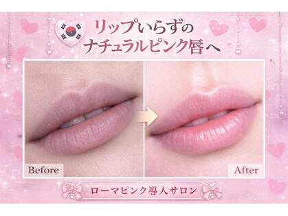 ルネル(Lunelle)の写真