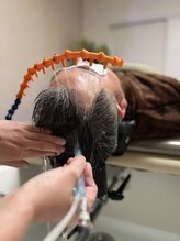 アンテイン(anthein)/先進養毛プログラム