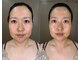 イヴジュ サロン(YVESJU SALON)の写真/【圧倒的リピート率◎】お顔の円周率をひとまわり小さく小顔に！ハリ艶、リフトアップも同時に叶う★