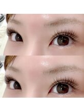 ビューティーアイ 鳳店(Beauty Eye)/バインドロック100束