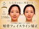 モアフェイス 池袋店(More Face)の写真