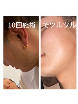 エンムスビ(enmusubi)/