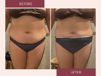 ドットカノア(.Kanoa)/お客様のbefore/after