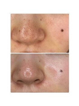 ジェシカ 荻窪店/韓国で大人気のララピール