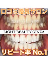 ライトビューティー 銀座店(LightBeauty)/東銀座　ホワイトニング症例写真