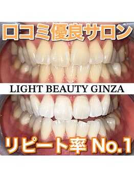 ライトビューティー 銀座店(LightBeauty)/東銀座　ホワイトニング症例写真