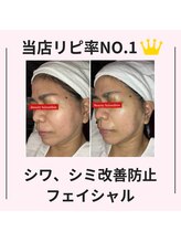 シン(Shin)/【シミ、シワ改善】