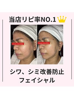 シン(Shin)/【シミ、シワ改善】