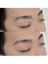 ルーフアイ(ROOF EYE)/ROOF EYE(ルーフ アイ)