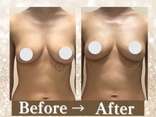 エクラパピヨン 荻窪(Eclatpapillon)/9.施術後のカウンセリング