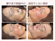 メイクアップスタジオ ウィッシュ(Make up Studio Wish!)