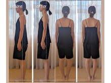 ユーニマルヨン(ewe204)/産後美容整体(姿勢矯正＋リンパ)