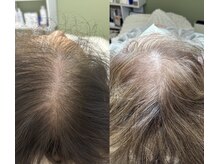 ミヨン(Miyong)の雰囲気（育てる環境が大事です）