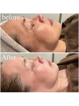 ビュウナ 銀座(BEAUNA)/シルクブライト