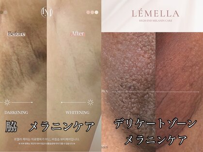 リリーイー(LILY E)の写真