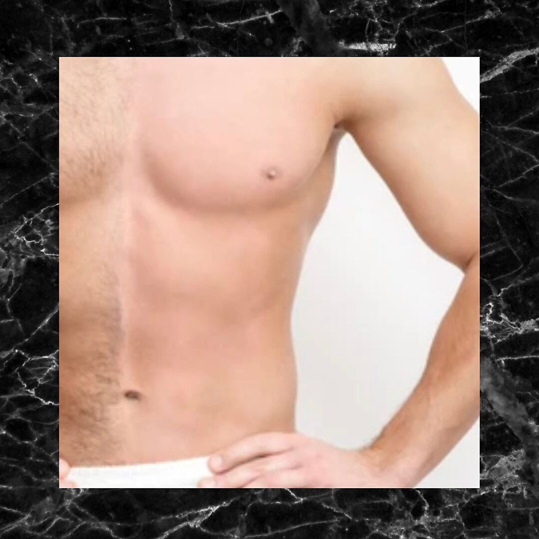 新規、再来【メンズ脱毛】全身脱毛(顔orVIO) 最新LED脱毛　