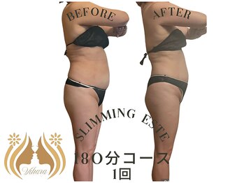 ビハーラ 門司店/3ヶ月で結果出し痩身リンパ/門司