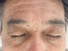 コリン 相模原(Corin)/アイブロウ　ビフォー