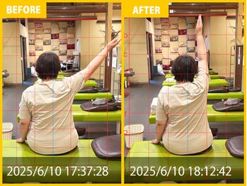 整体院 元 宇城松橋店/肩関節外転時痛の悩み