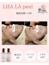 肌イズム 守谷店(肌ism)/【before&after】ララピール