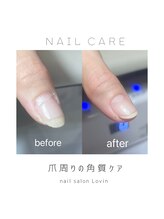 ラヴィン なんばスカイオ店(Lovin)/【パラジェル】角質ケア