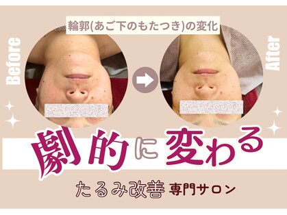 ココリラ(cocorela)の写真