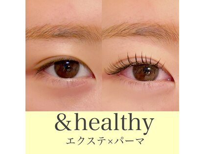 リンダ(LINDA)の写真