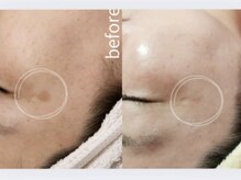 カヌヌ(kanunu)/シミケア