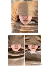 いちごいちえ/小顔矯正のビフォーアフター