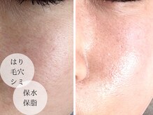 サロンパッテデシャット(salon patte de chat)の雰囲気（メニュー詳細、ビフォーアフター写真を沢山ご用意しております♪）